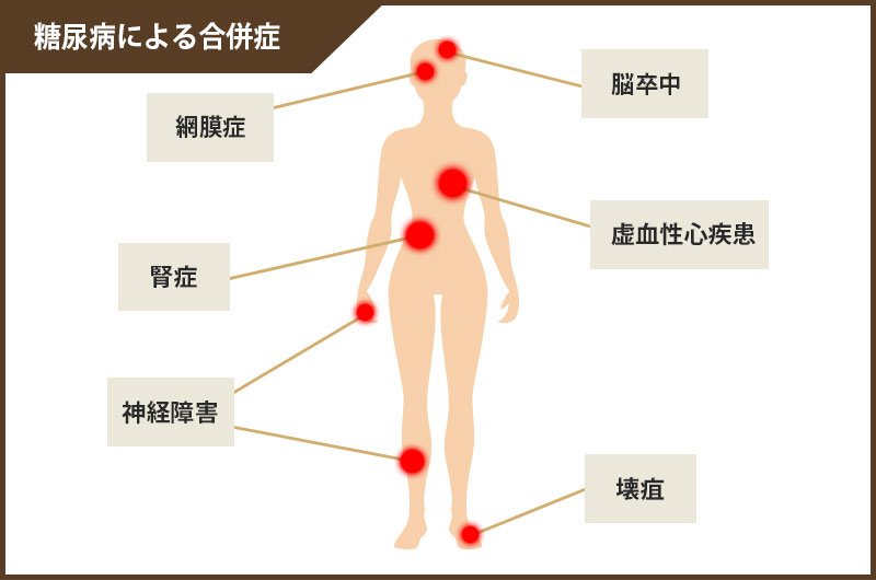 糖尿病による合併症
